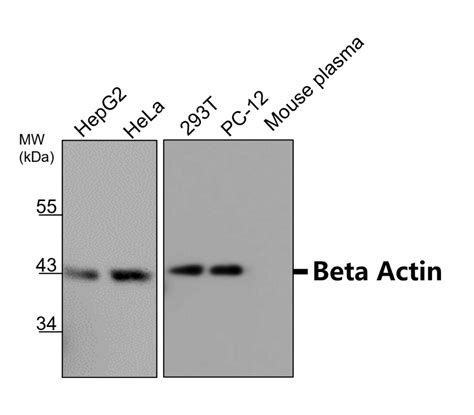 beta actin antibody|Beta Actin Antibody (600.